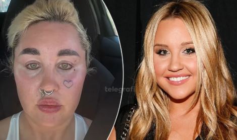 Transformación física de Amanda Bynes después de usar Ozempic para el control de peso y salud mental