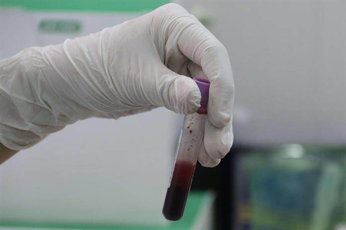 Investigadores analizan muestras de sangre con la tecnología de biopsia líquida MethylScan en laboratorio