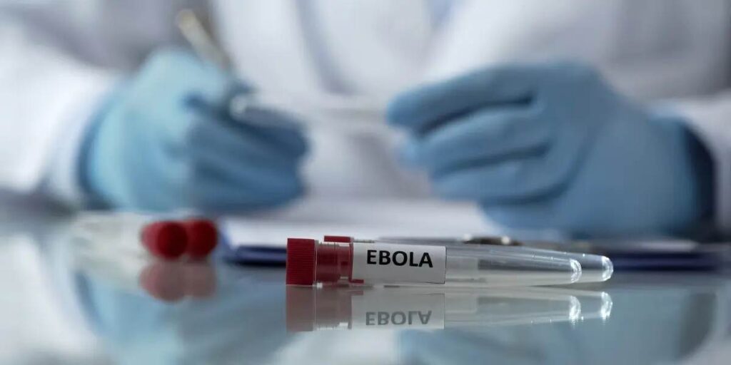 El Gobierno activa el control sanitario en Venezuela para viajeros de zonas con ébola