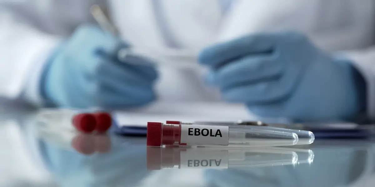 El Gobierno activa el control sanitario en Venezuela para viajeros de zonas con ébola
